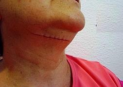 Una de las víctimas muestra las heridas producidas por el detenido. IDEAL/