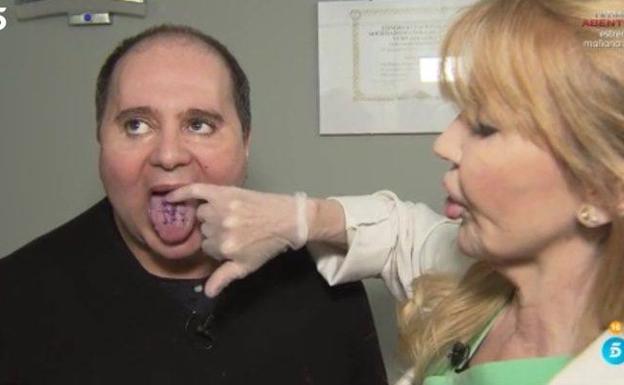 Mallita en la lengua para adelgazar
